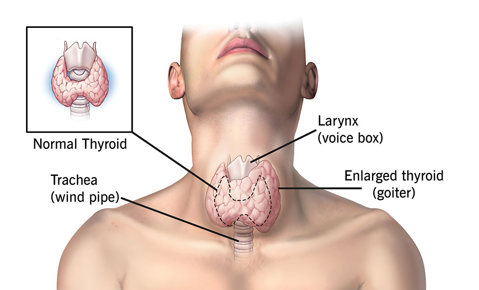 what is natural thyroid medication
