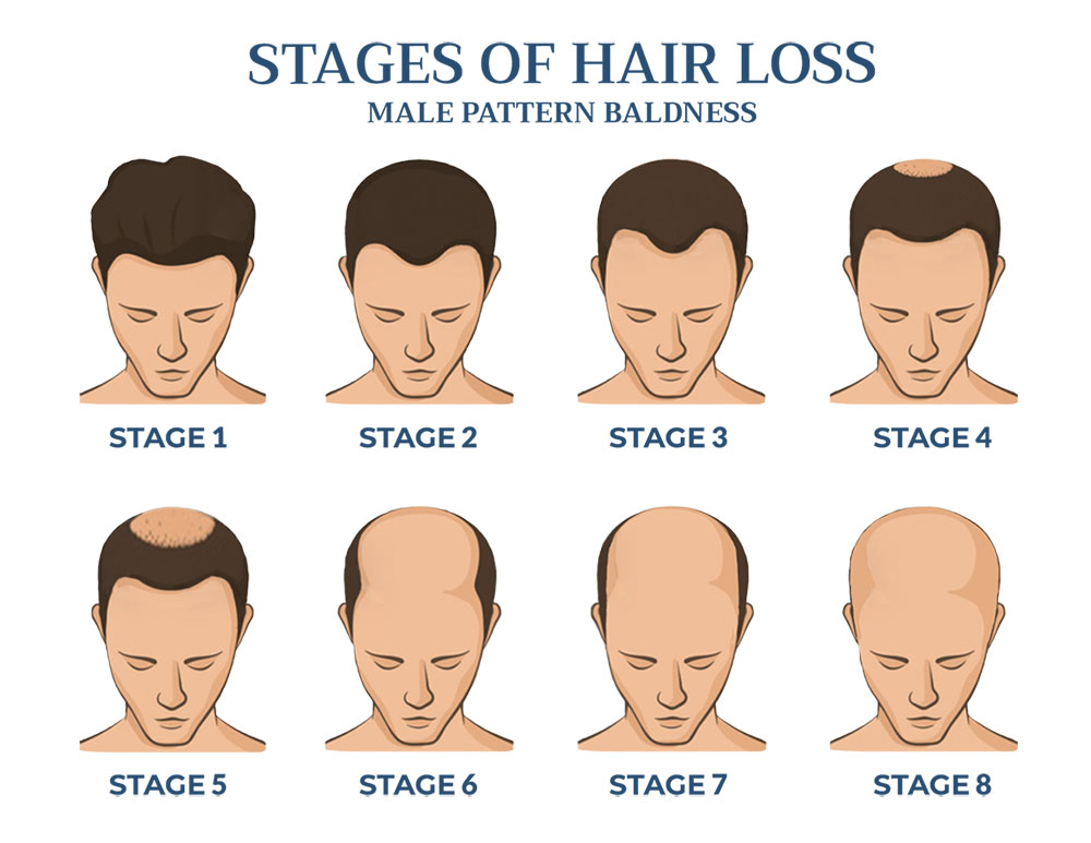 does hgh help hair regrowth male baldness